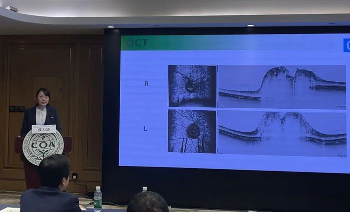 咸阳市第一人民医院眼科团队亮相国际国内学术舞台