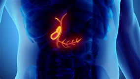 天天吃早饭，为什么还会得胆结石