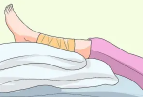 【科普】深静脉血栓的预防