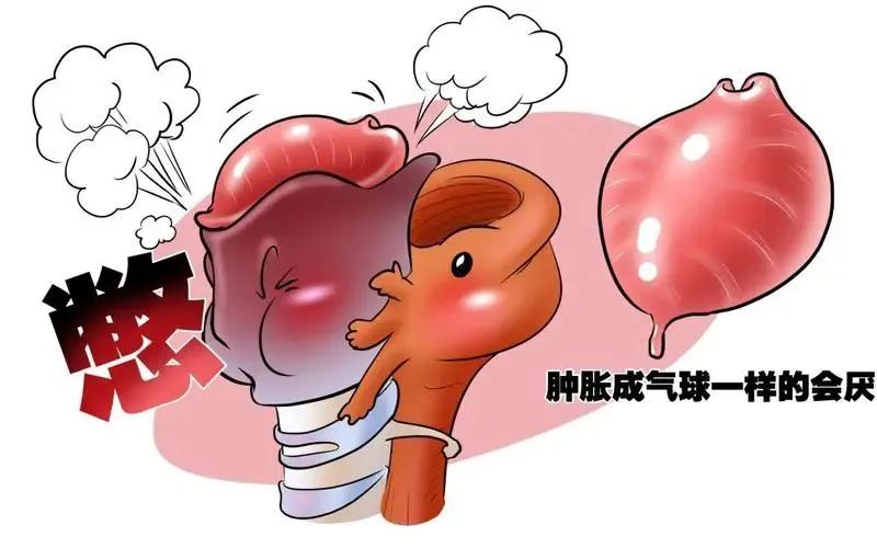 急性会厌炎：会伪装成感冒、咽炎或卡刺！